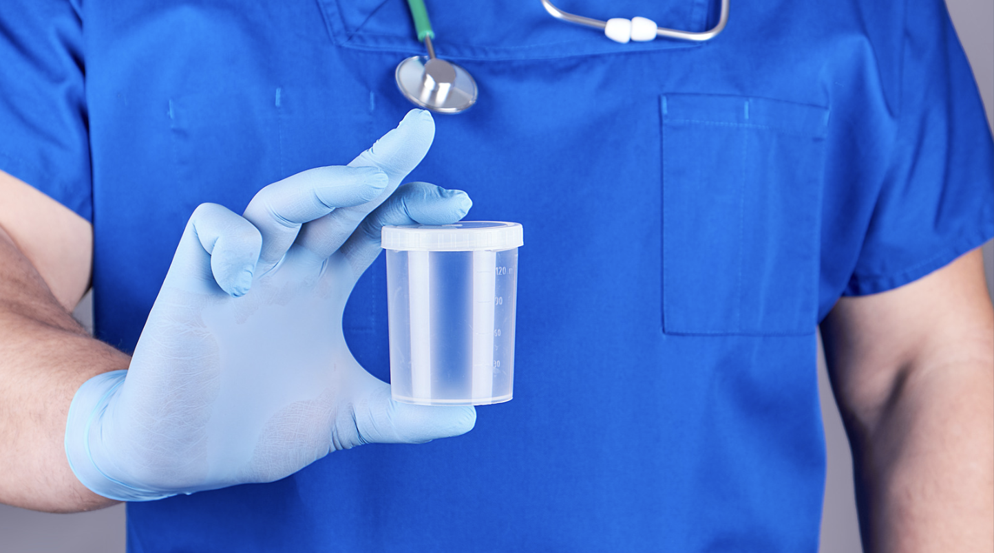 Gloved hand holding an empty sample cup for drug testing 