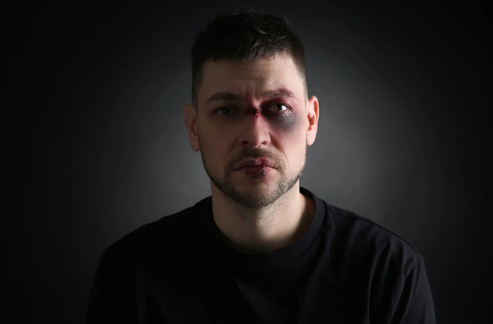 a man in a dark room with wounds on his face from abuse